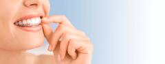 Tot ce trebuie să știi despre tratamentul de îndreptare a dinților cu ajutorul aparatului dentar invizibil invisalign®