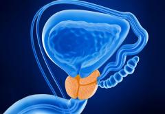 Leziunile canceroase în prostată apar la vârste tot mai tinere