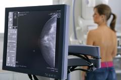 Gesturi care salvează viața în cancerul de sân