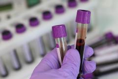 Peste 75% dintre infecțiile cu COVID-19 au fost la persoane nevaccinate