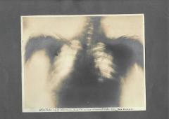 Radiografia lui Brătianu va fi expusă după 112 ani de la atentat 