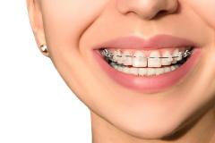 Remediul pentru bruxism, boala scrâşnitului dinţilor