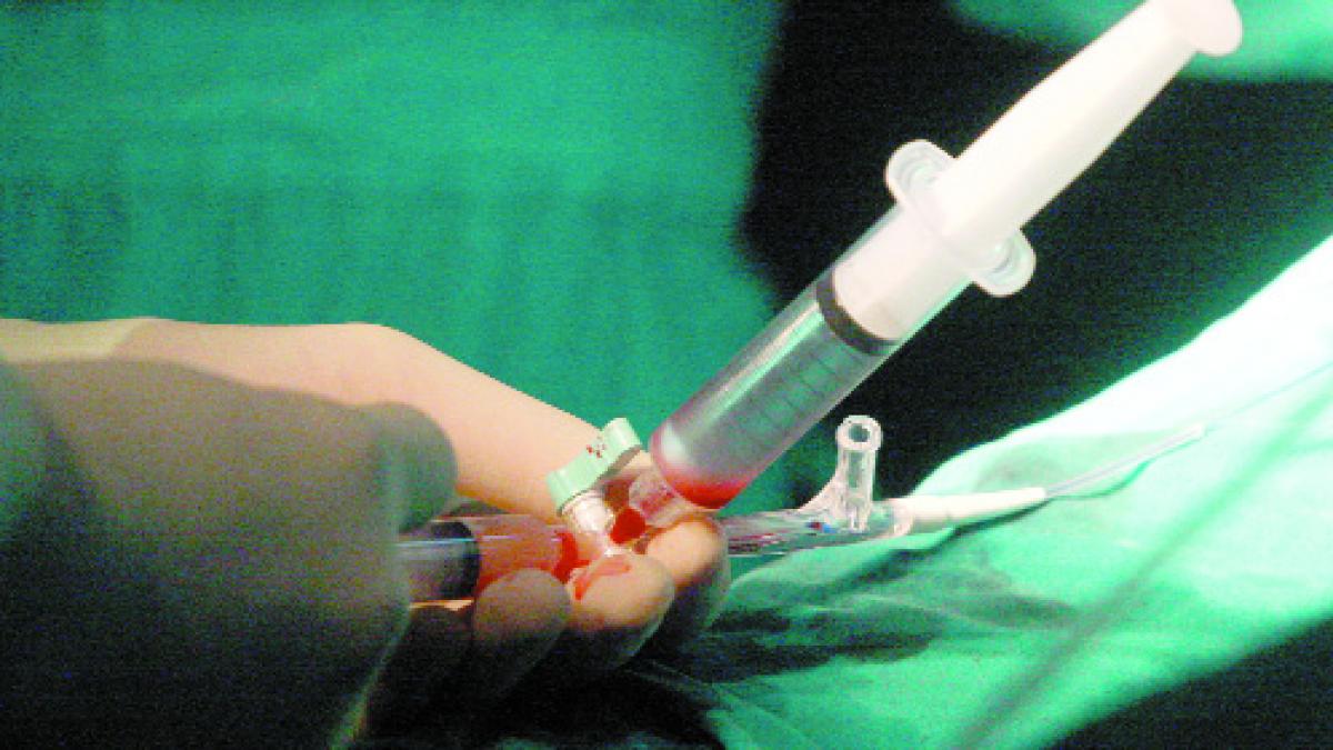 Semnal  - Implant de celule stem la Sinaia?
