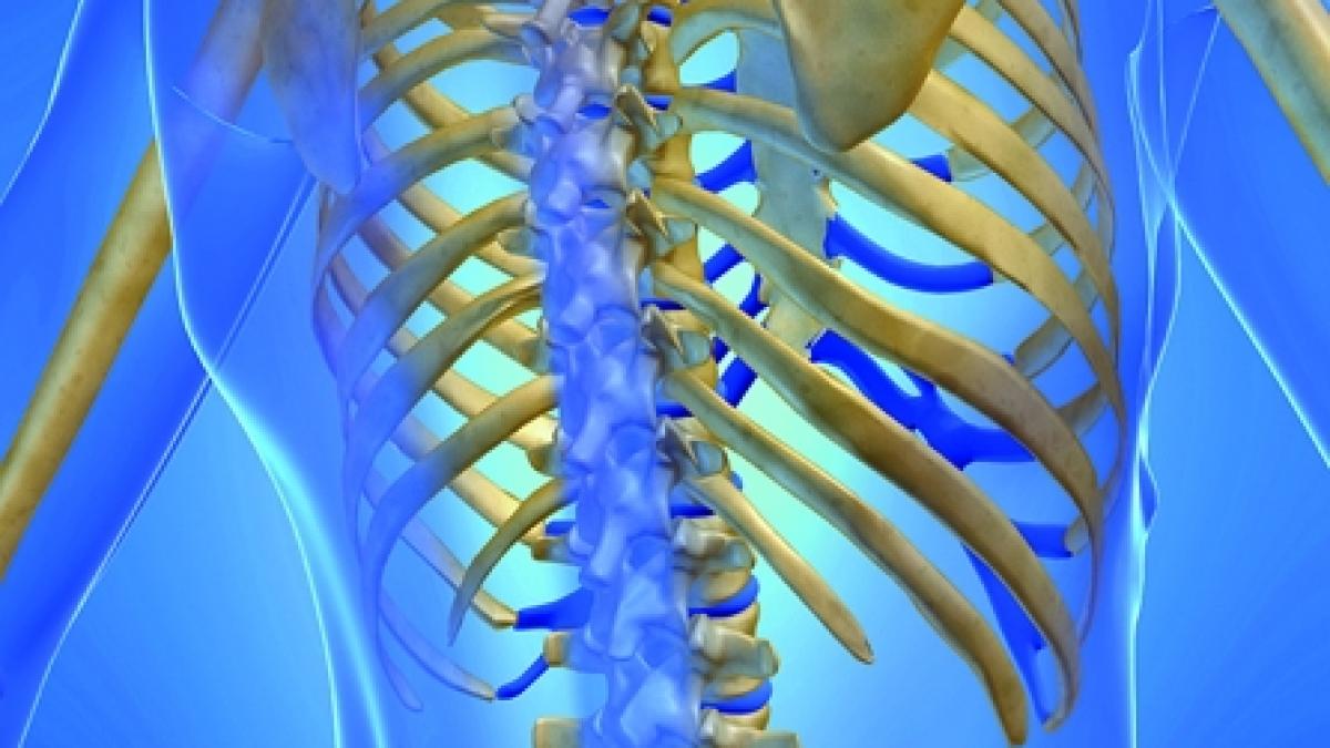 Osteoporoza, coşmarul oaselor
