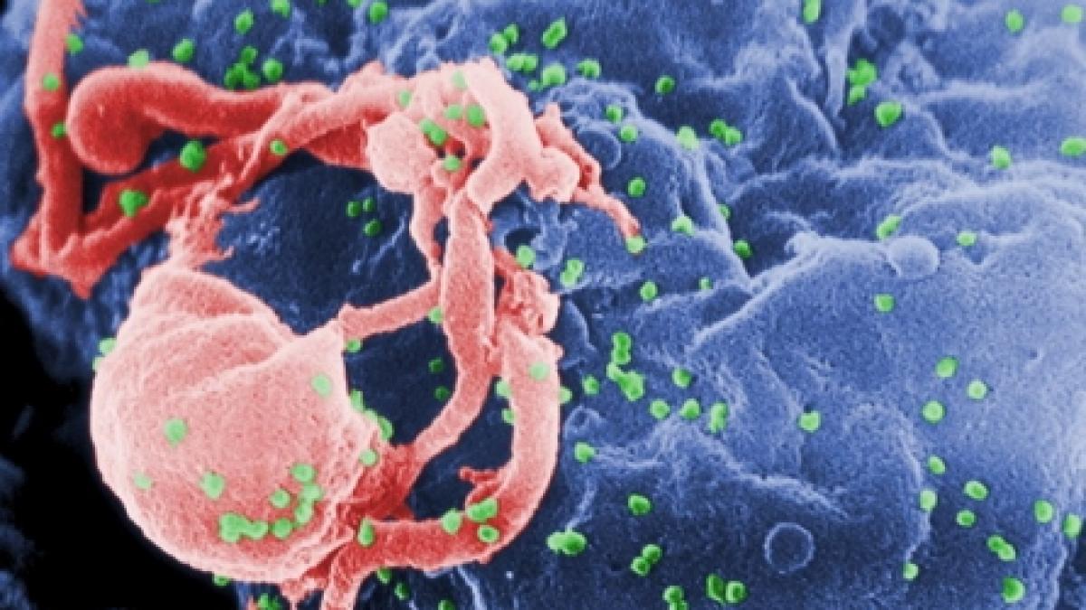 Vaccinul împotriva SIDA, tot mai aproape de realitate