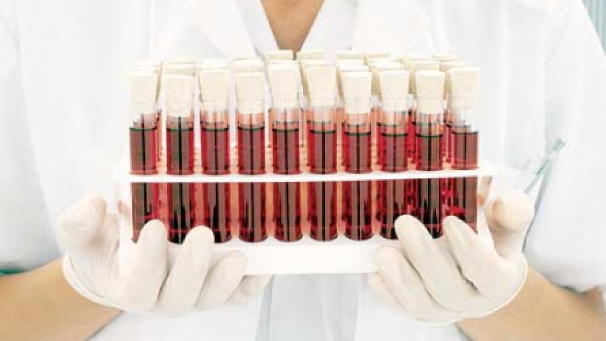 Asociaţia Lupus România