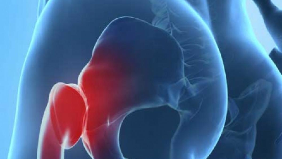 Osteoporoza de la unele medicamente şi boli