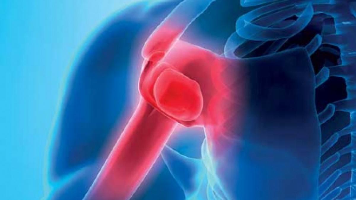 Reumatismul articular acut