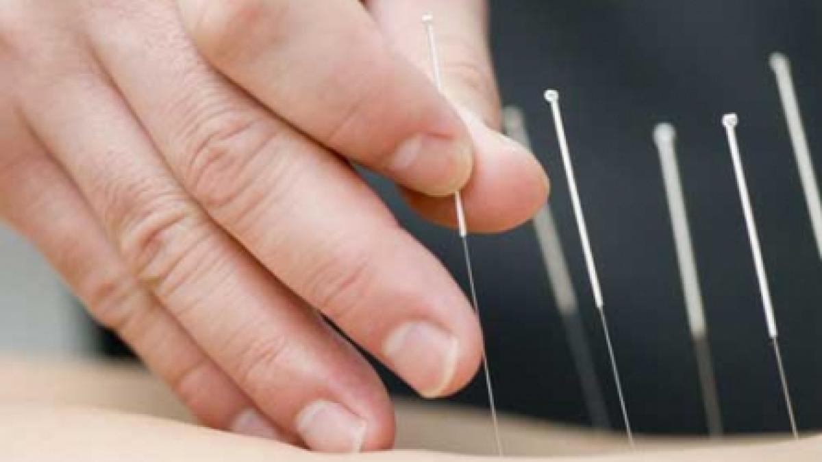 Acupunctura te păzeşte de infarct