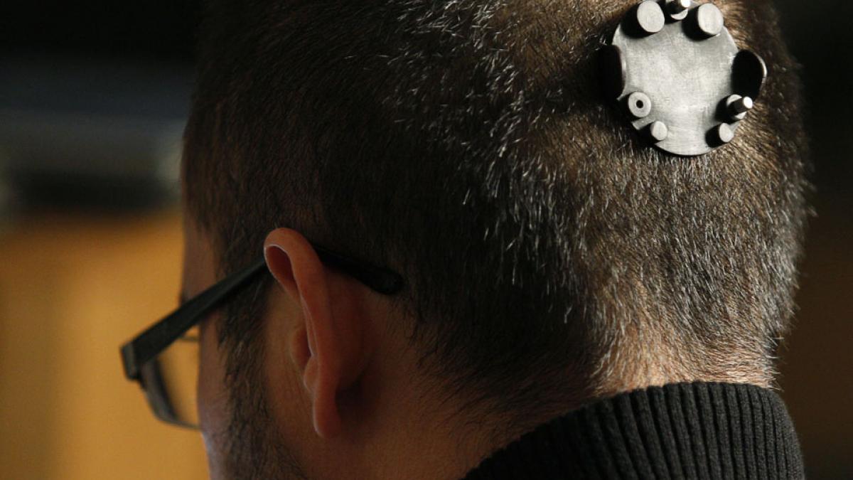 Şi-a implantat o cameră web în cap!