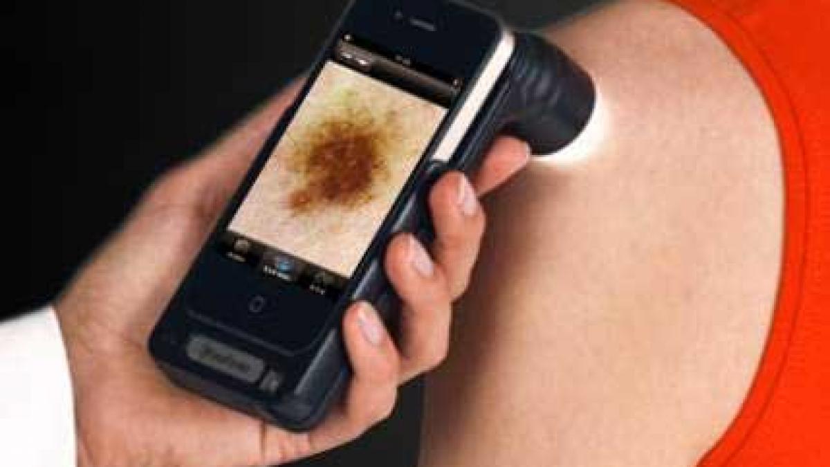 Depistarea cancerului se va face cu...telefonul mobil