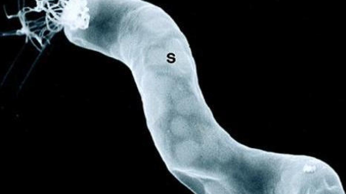 Un cercetător NASA susţine că a descoperit bacterii extraterestre!