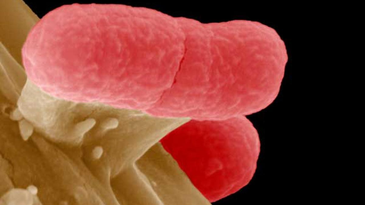 Infecţiile cu E.coli.