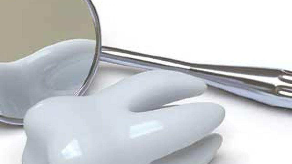Încrustaţii dentare – alternativă la plombele clasice.