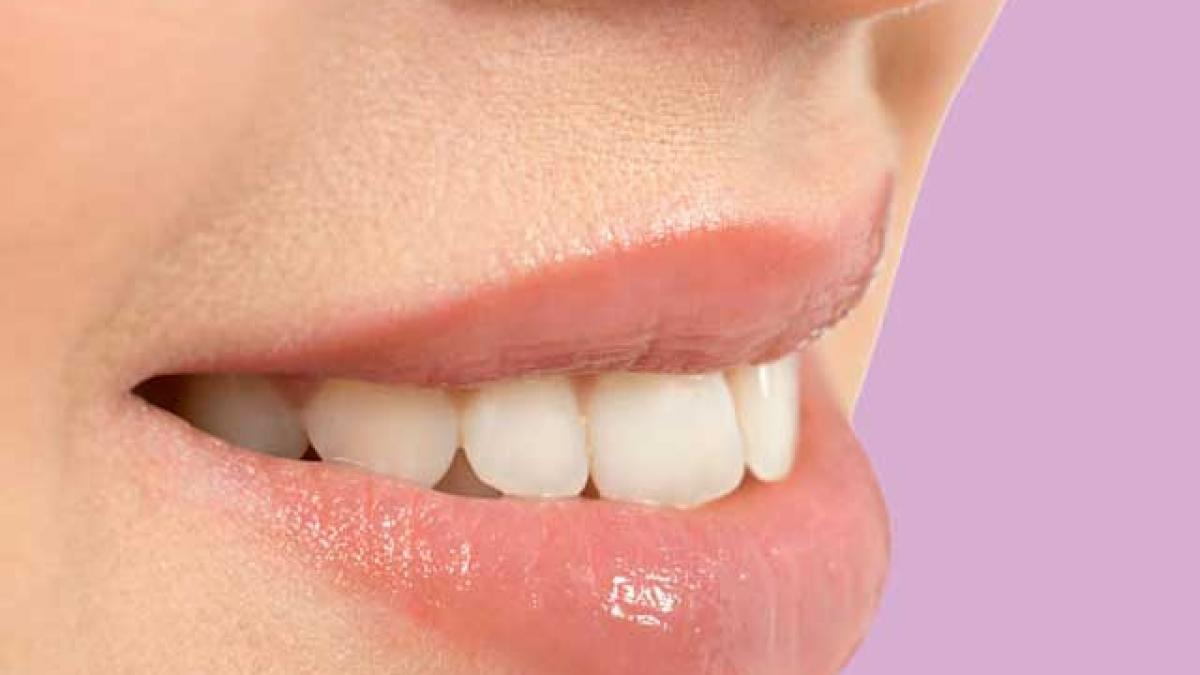 Tehnologia CAD-CAM - Metodă revoluţionară de realizare a lucrărilor dentare din zirconiu