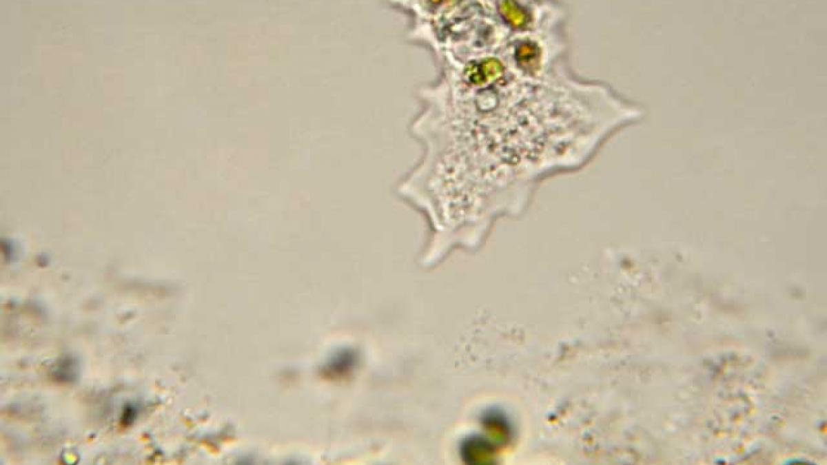 Amoeba care se hrăneşte cu creier uman, naegleria fowleri