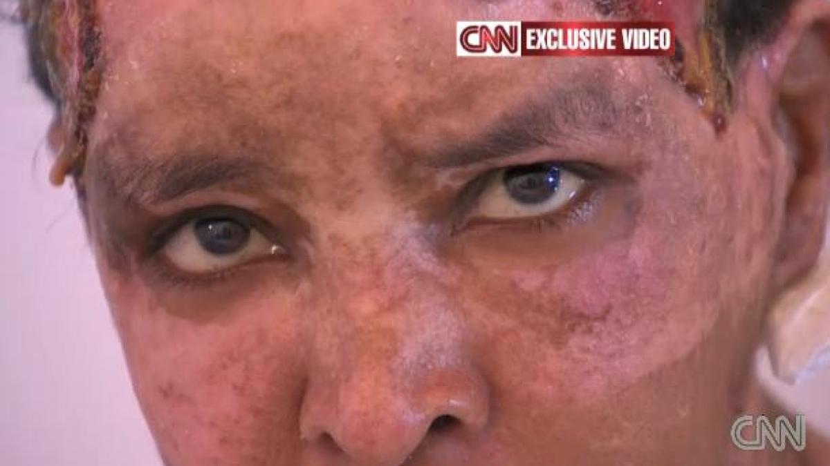 Bona nepoţilor lui Gaddafi, mutilată cu apă fiartă de nora dictatorului libian
