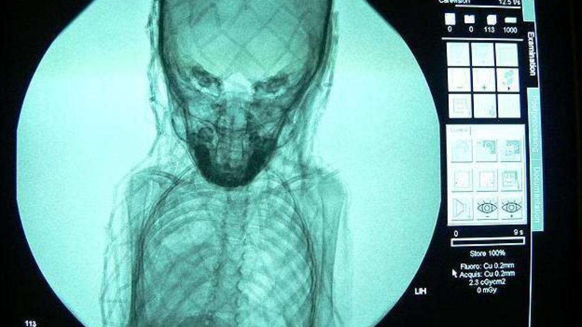 Misterul unei mumii, dezvăluit de o radiografie