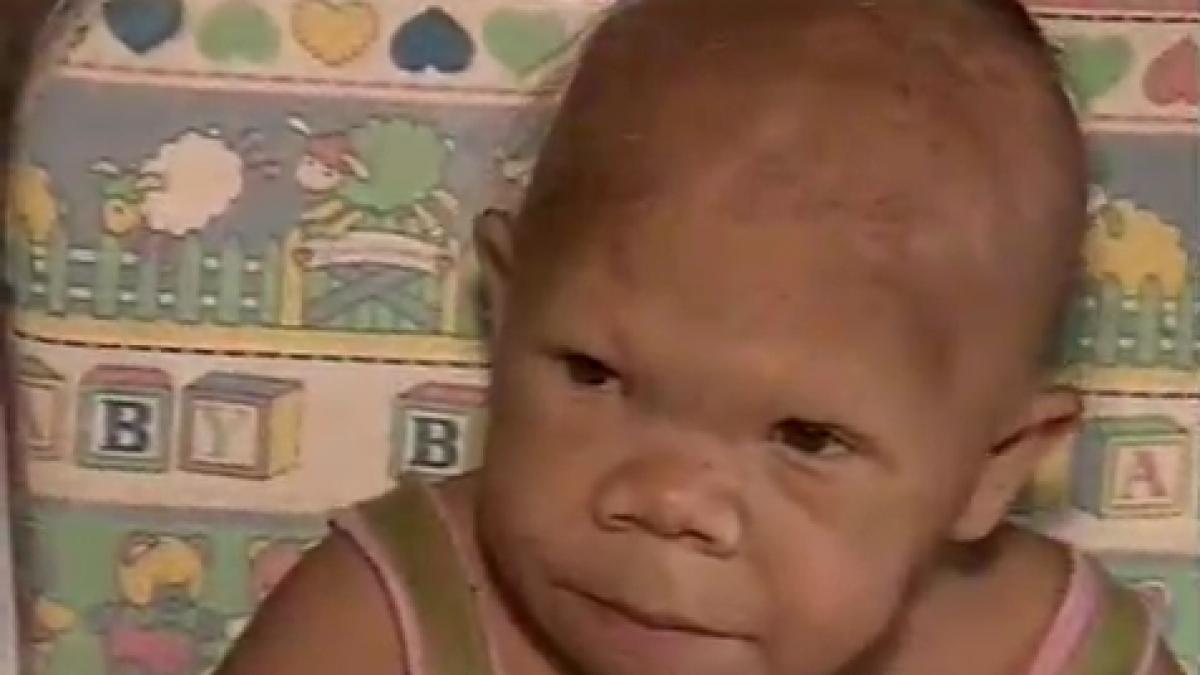 VIDEO. Caz medical incredibil. Are 30 de ani dar arată ca un copil de NOUĂ luni