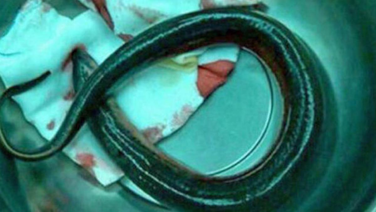 S-a prezentat la Urgenţă cu un ŢIPAR în rect. Ce explicaţie le-a dat medicilor