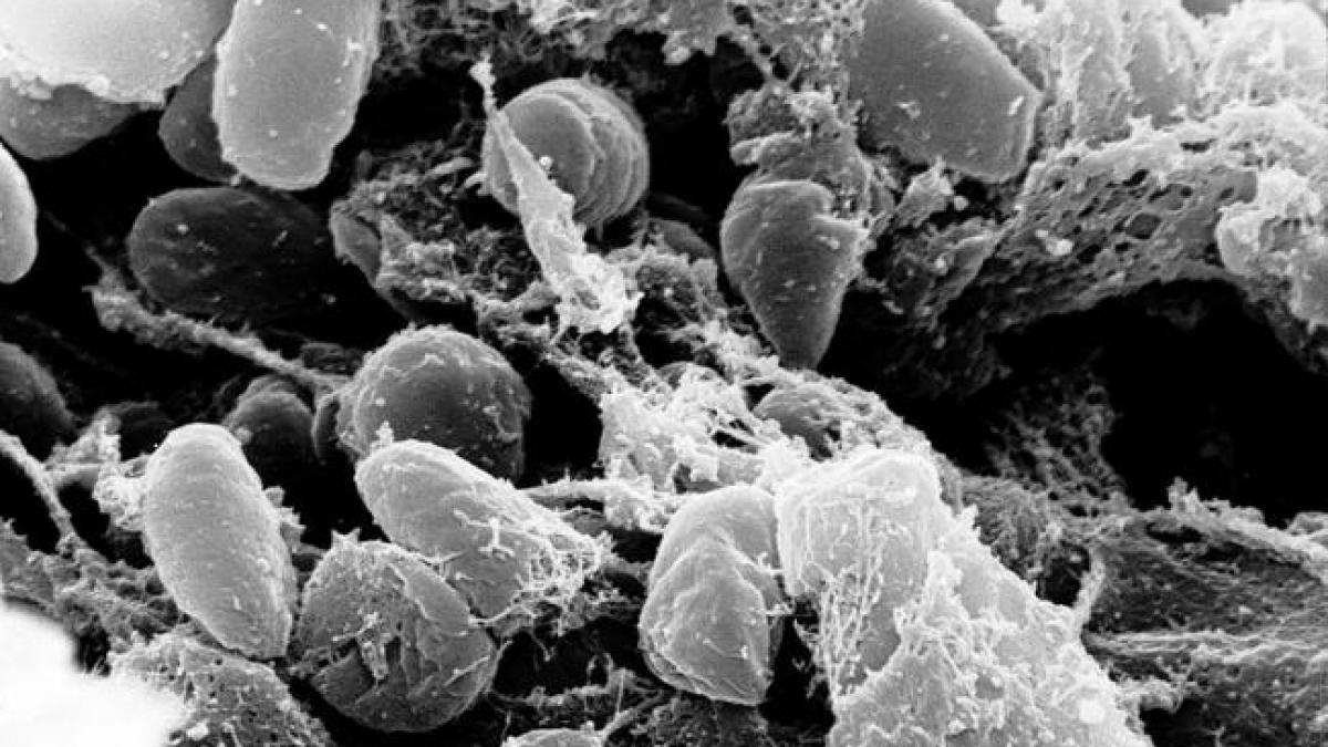 Ciuma bubonică. Peste 160 de persoane au fost spitalizate în Kârgâzstan