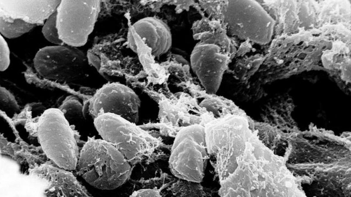 Genomul bacteriei care a provocat cele mai grave pandemii din istorie, reconstituit în laborator