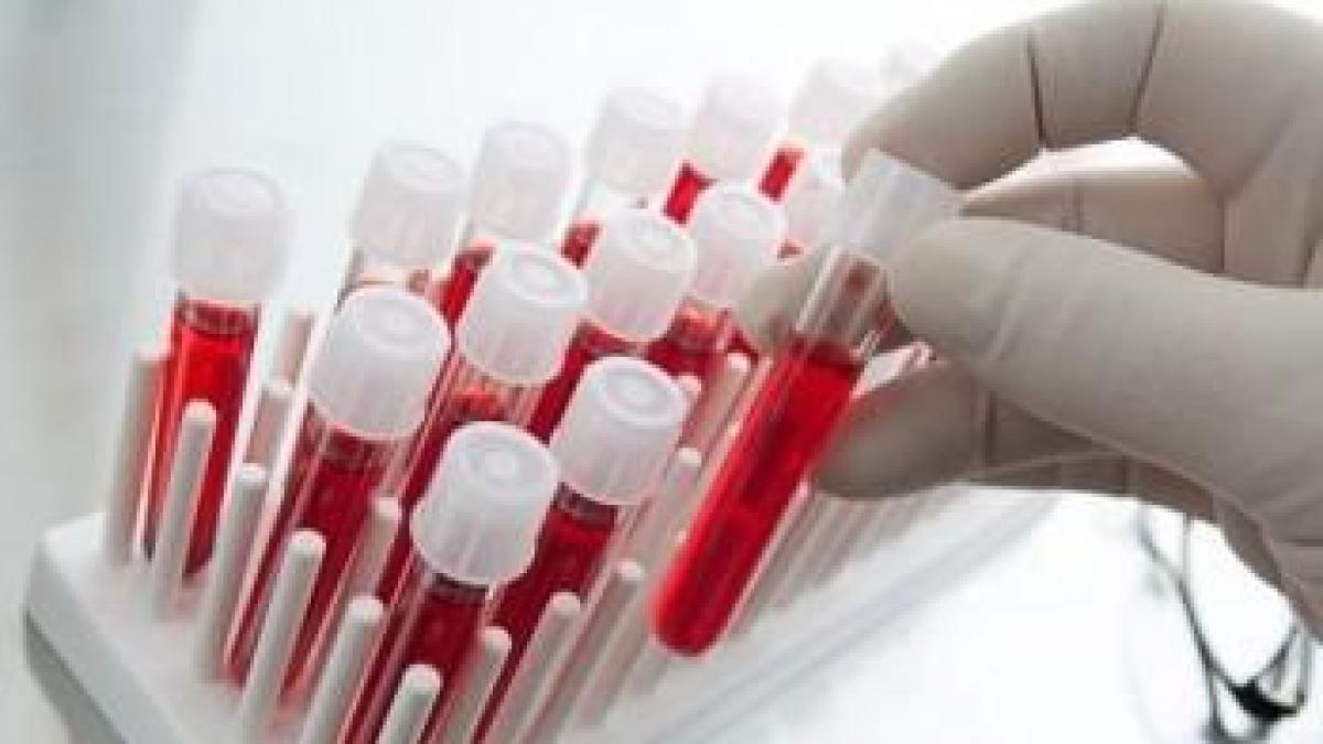 SIDA: Tratament cu celule modificate genetic contra HIV