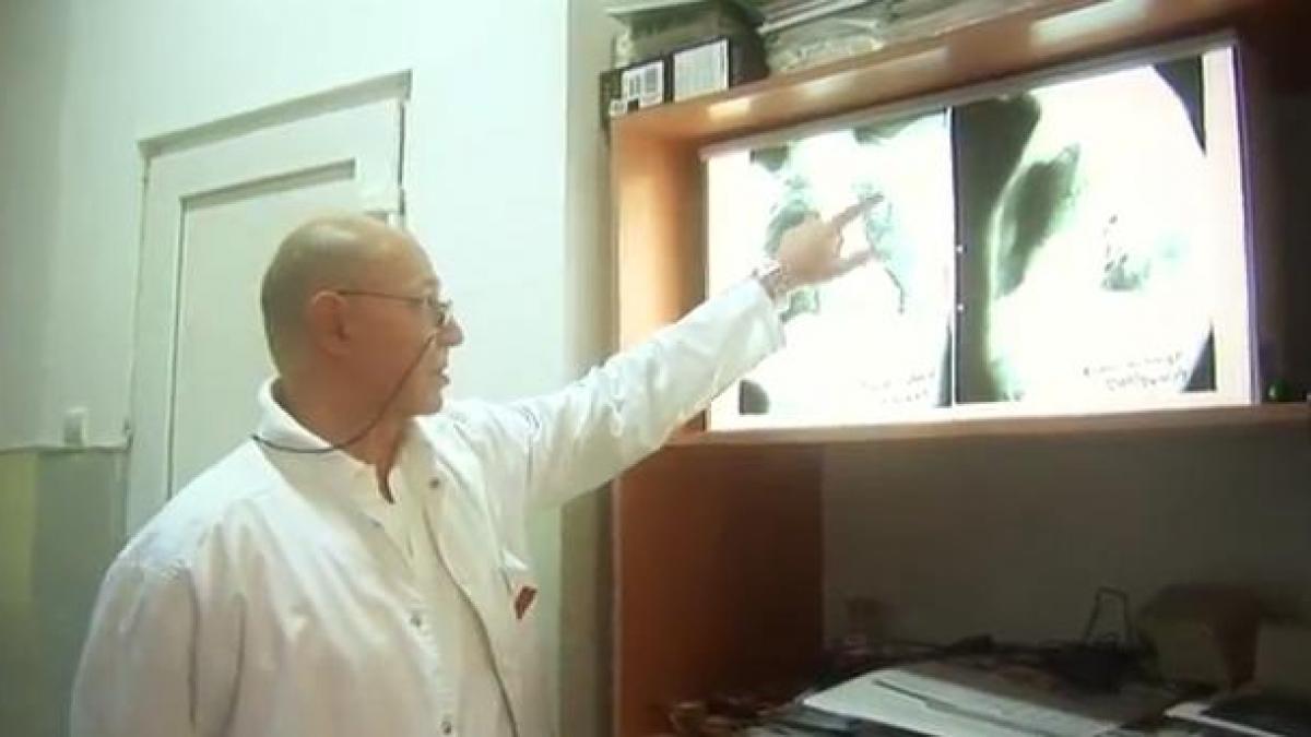 Aparatul laser care prelungeşte viaţa în metastaza pulmonară