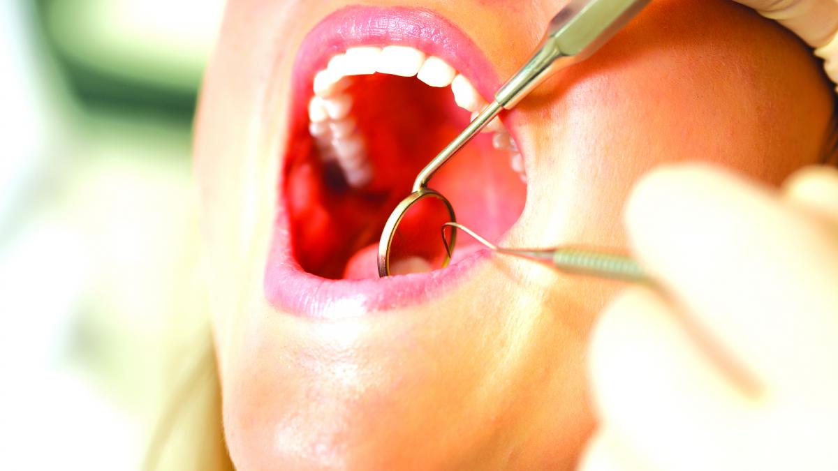 Implantul dentar, mituri explicate de un specialist