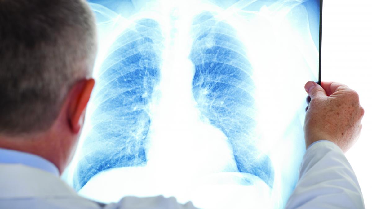 România, ţara în care cancerul este diagnosticat mult prea târziu