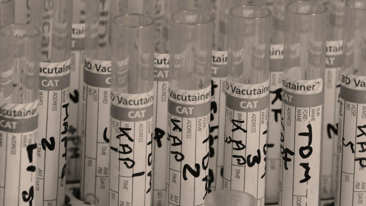 Românii se pot testa gratuit pentru HIV şi virusurile hepatice B şi C 