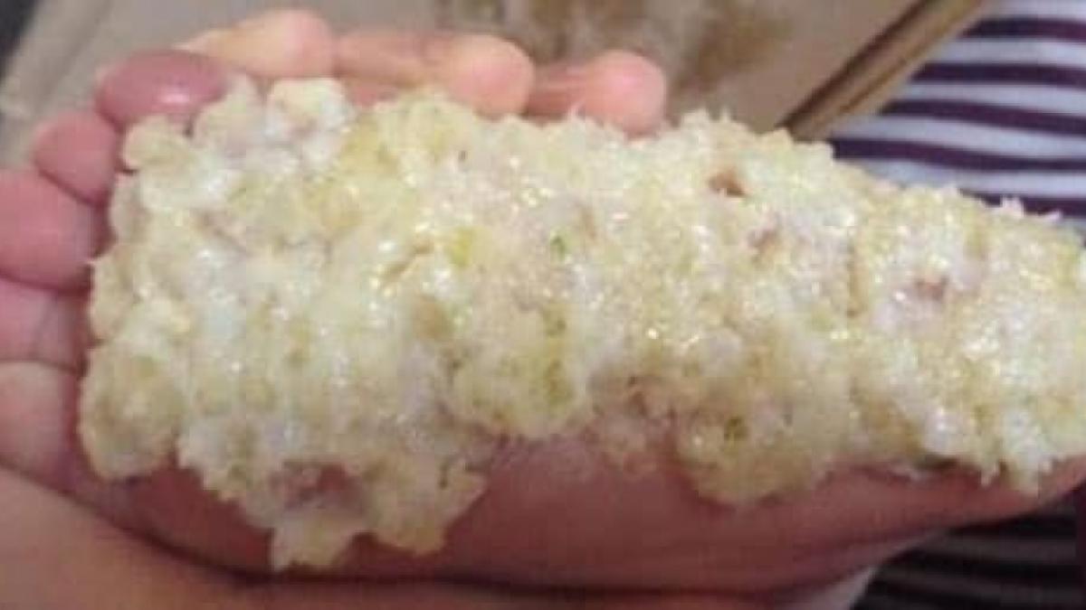 Tratamente naturiste. 6 rezultatele spectaculoase ale cataplasmei cu usturoi aplicată pe tălpi
