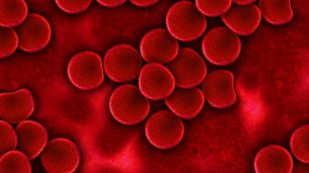 Septicemia. Care sunt simptomele asociate acestei boli?