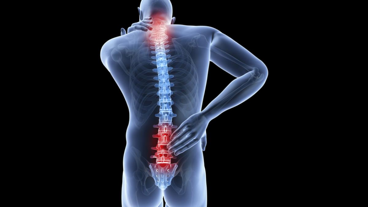 Hernia de disc netratată provoacă dureri de cap, alergii sau probleme cu ficatul