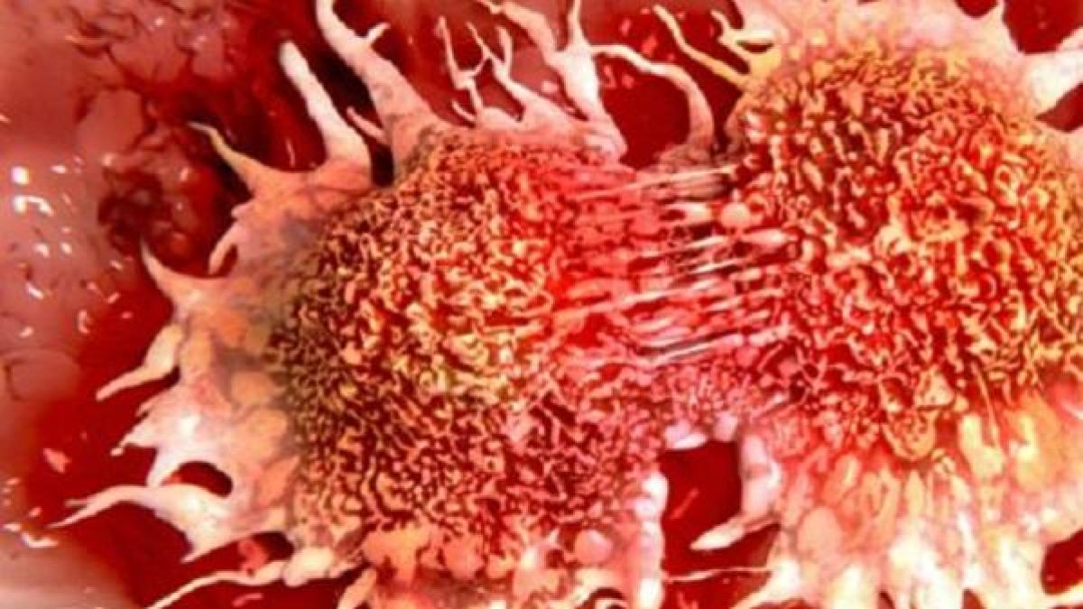 10 factori care cauzează cancer. Folosim zilnic aceste produse