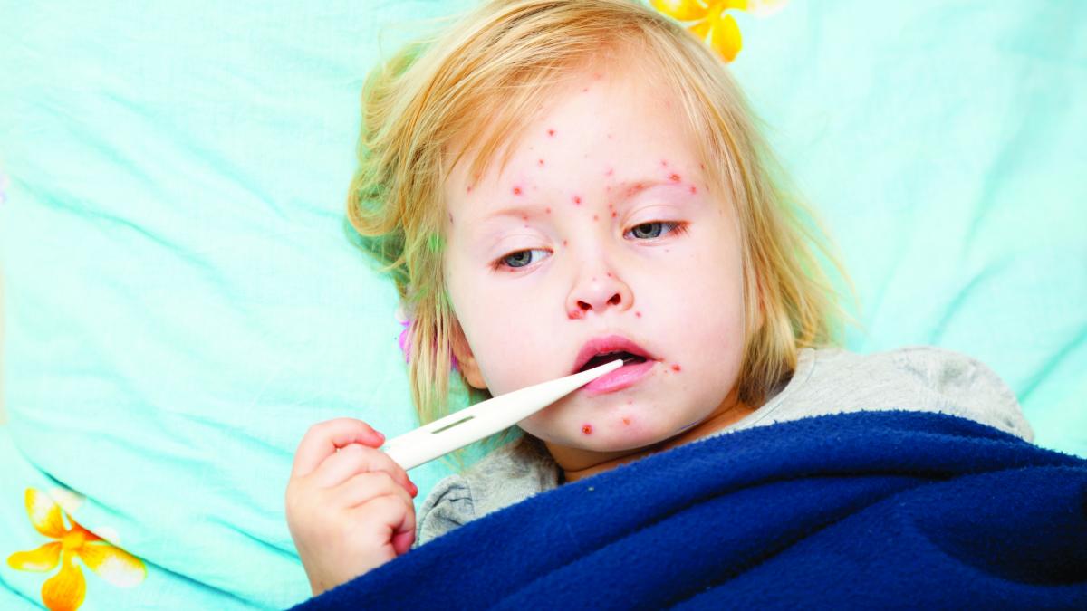 Sfatul medicului: Cum se tratează rujeola la copiii mici