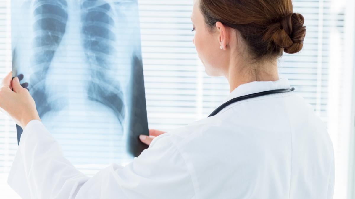 Cancerul “tăcut” face tot mai multe victime