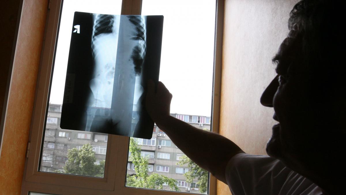 În Galați numărul persoanelor cu viroze respiratorii şi pneumonii, în creştere