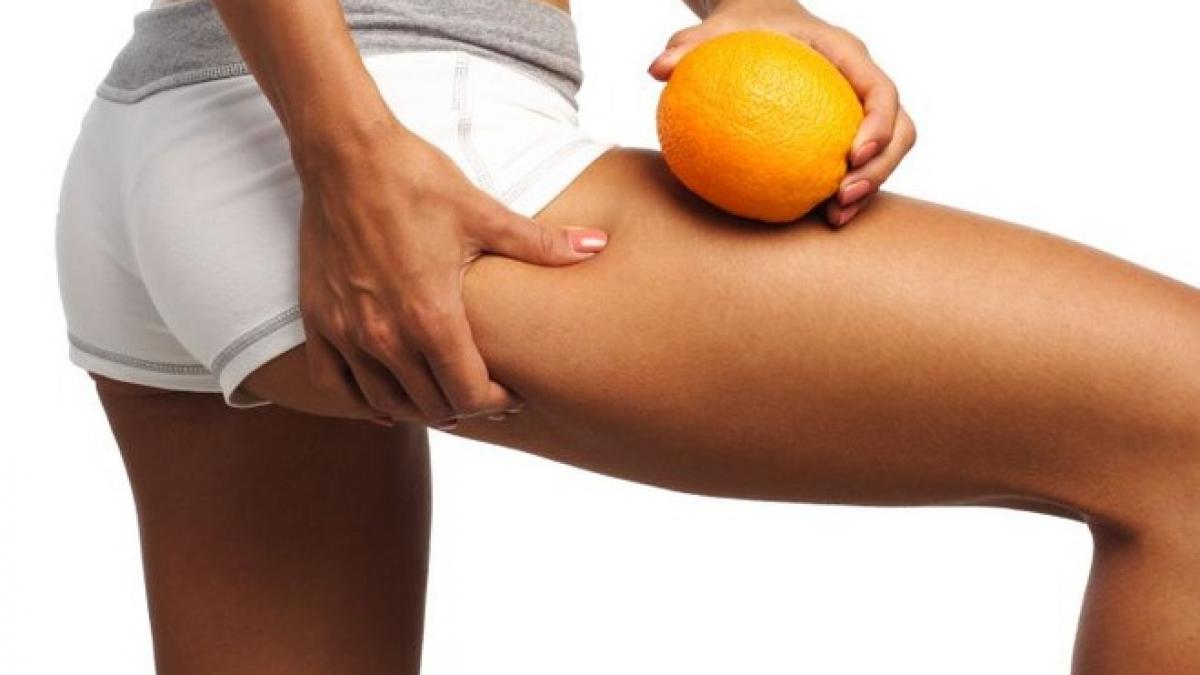 10 alimente anticelulită