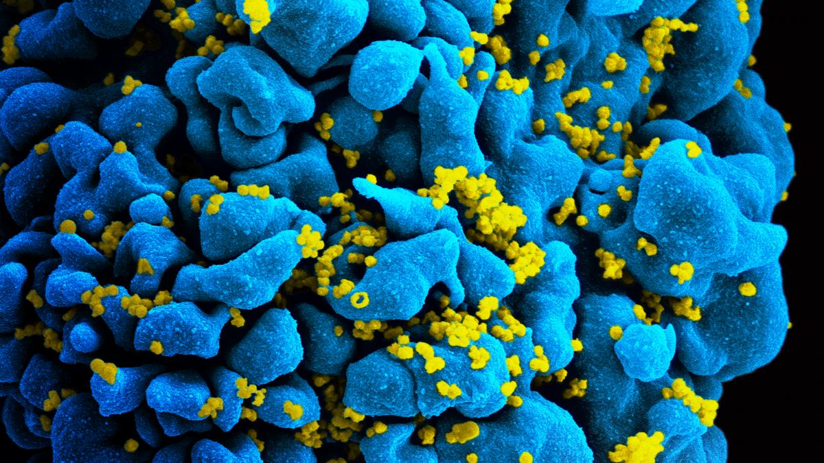 Un copil tratat de HIV la naştere este sănătos fără alte tratamente