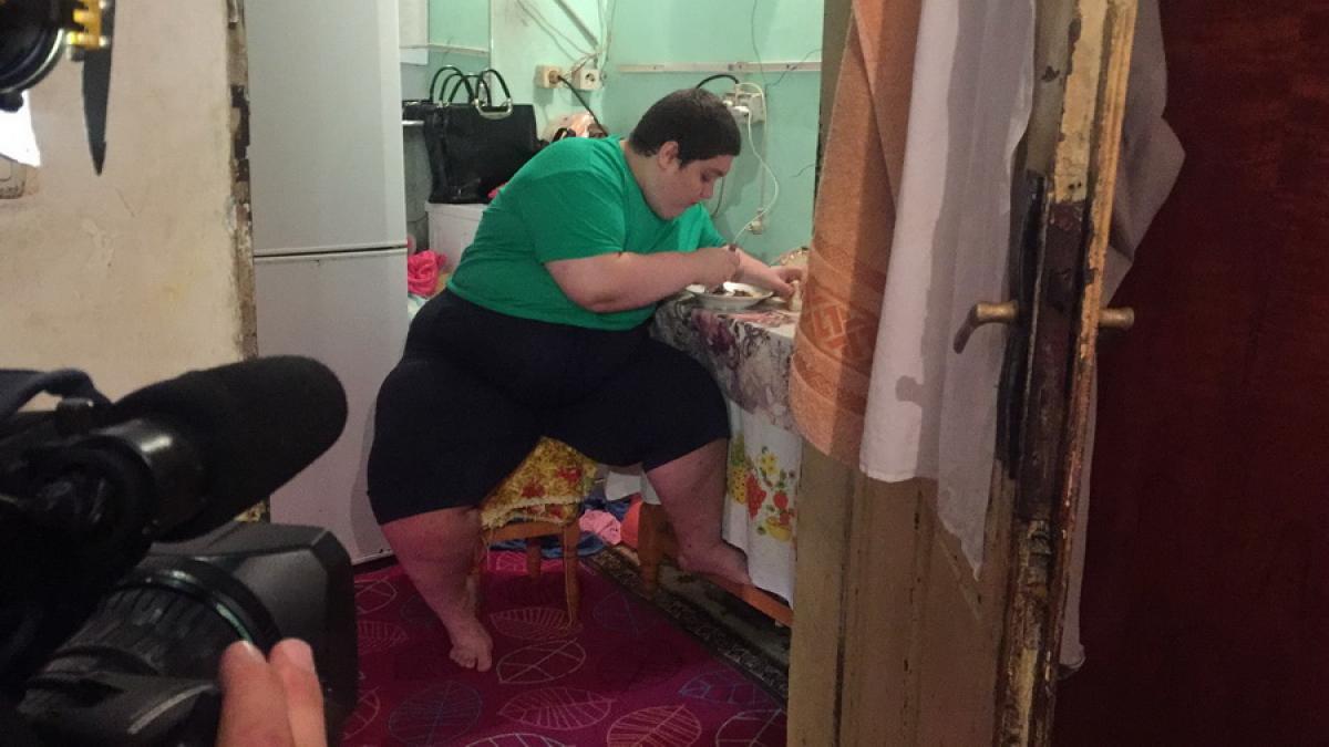 Obezitatea, lupta nedreaptă a copilăriei