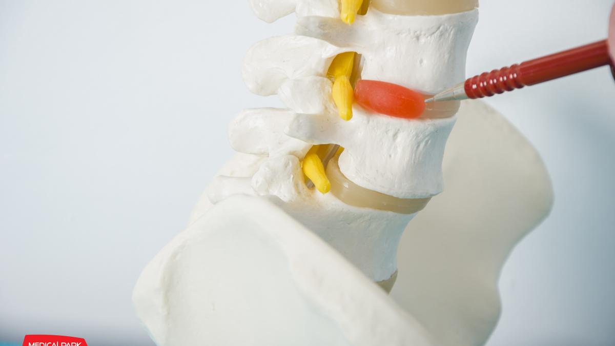 Munca la calculator şi hernia de disc cervical