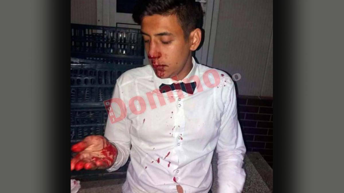 Polițistul care a snopit în bătaie la nunta sa un chelner și-a vizitat victima la spital ca să-i aducă... reproșuri