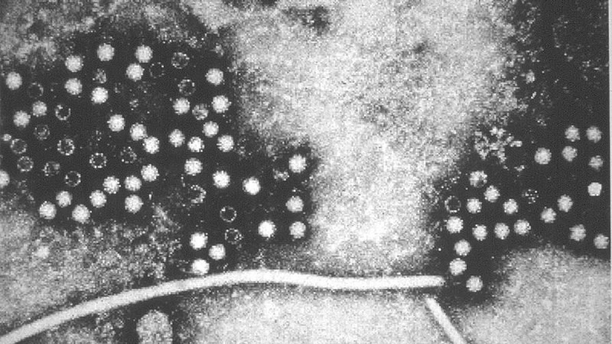 Primul caz uman diagnosticat cu hepatita E a șobolanilor