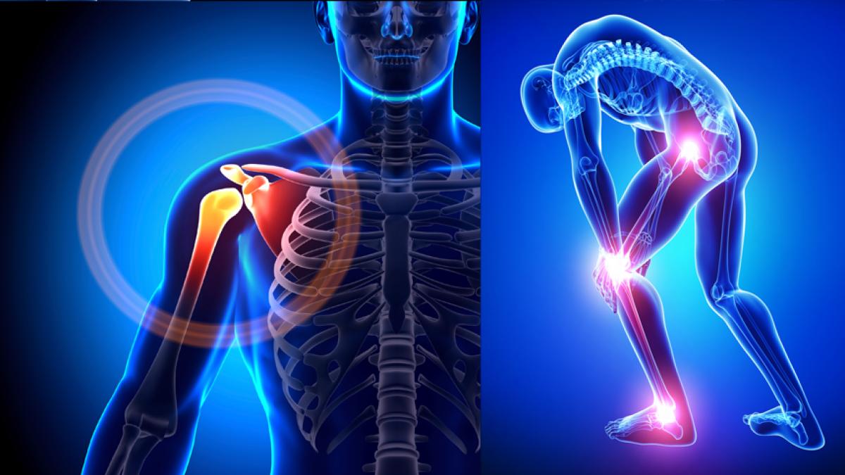 durere sub rotula la extensie artrita reumatoidă a genunchiului