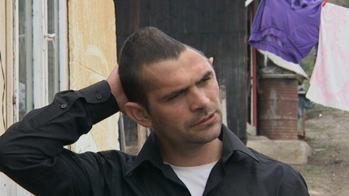 Reconstrucție de craniu reușită - pacientului i se dăduseră zero șanse de recuperare