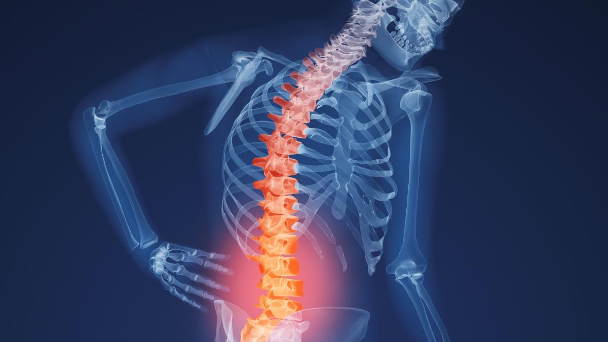 Lupta cu osteoporoza începe în adolescenţă