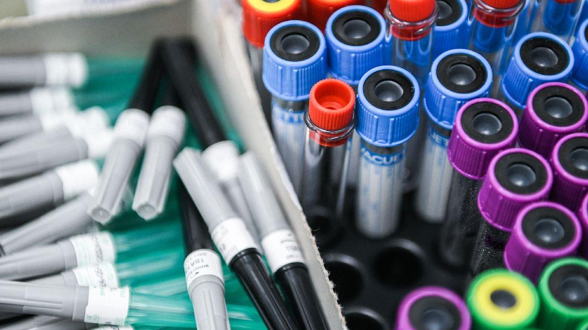 Descoperire îngrijorătoare: Noul coronavirus a evoluat pentru a infecta mai uşor celulele umane