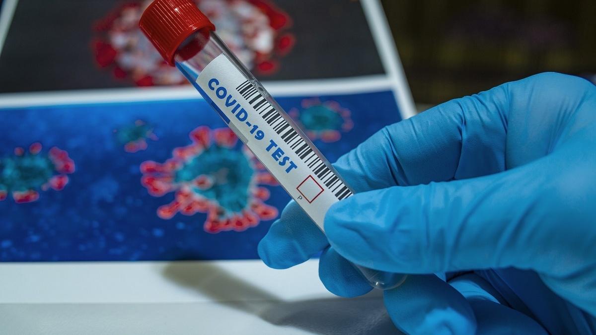 O angajată a Centrului de Recuperare Ionășeni este infectată cu COVID-19