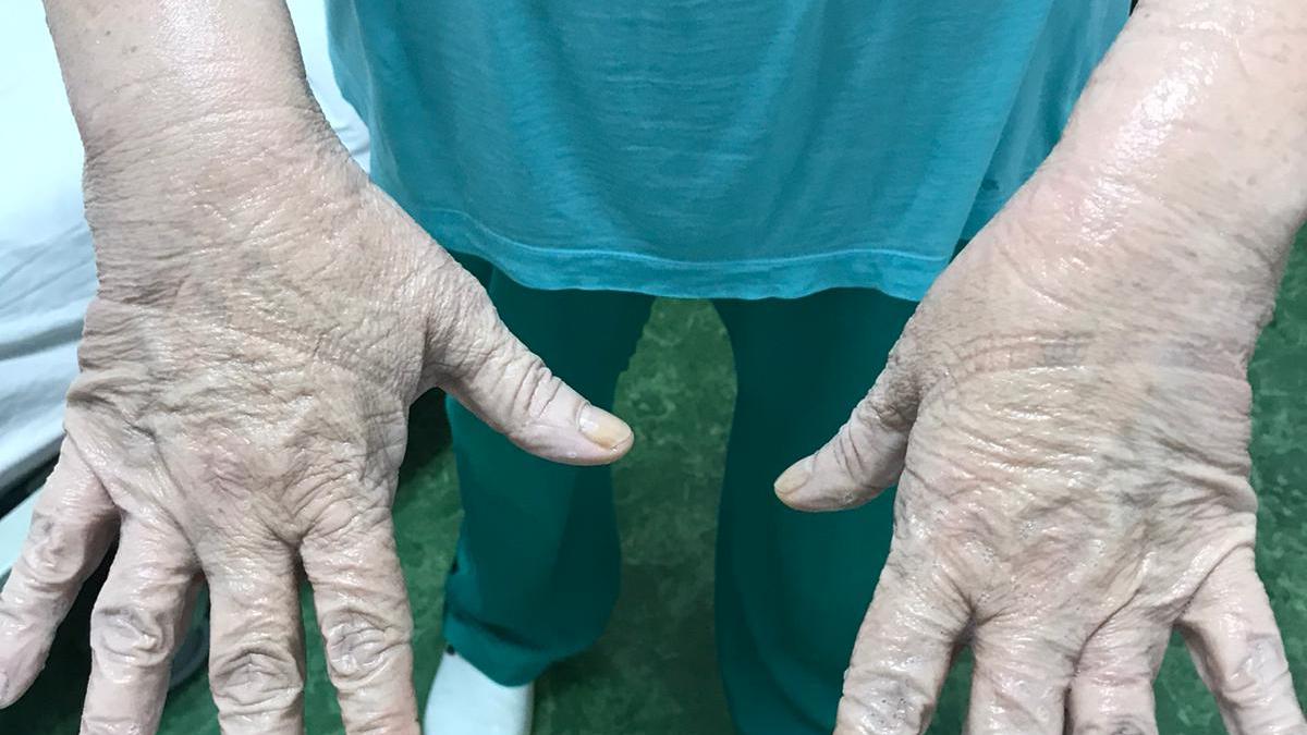 Triaj în corturi la peste 40 de grade
